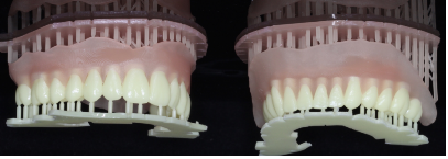 #   Impressora 3D Phrozen OdontoMega