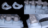 #   Impressora 3D Phrozen OdontoMega